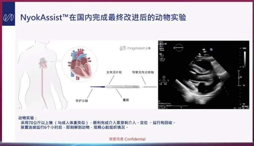 心擎医疗NyokAssist介入式人工心脏获国内外专家高度关注与认可